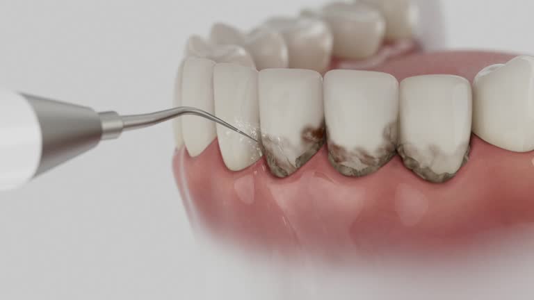 Reliable Dental contractor in Johnson County County, IA by Dentist Open Now